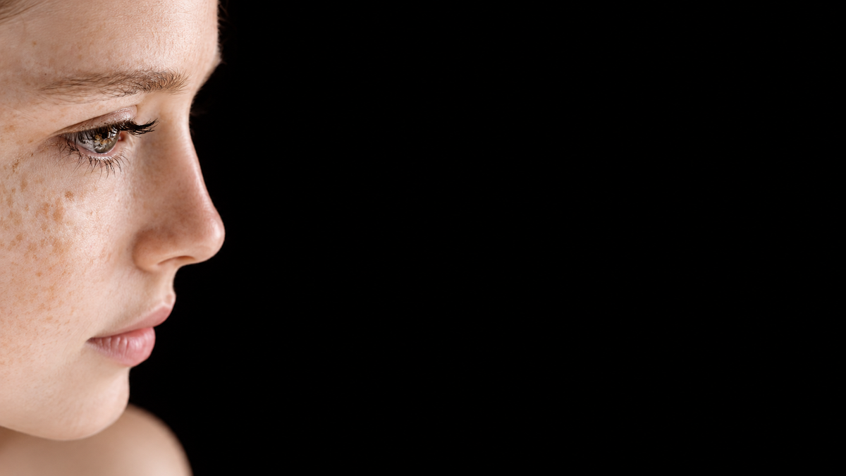 Skin Pigmentation