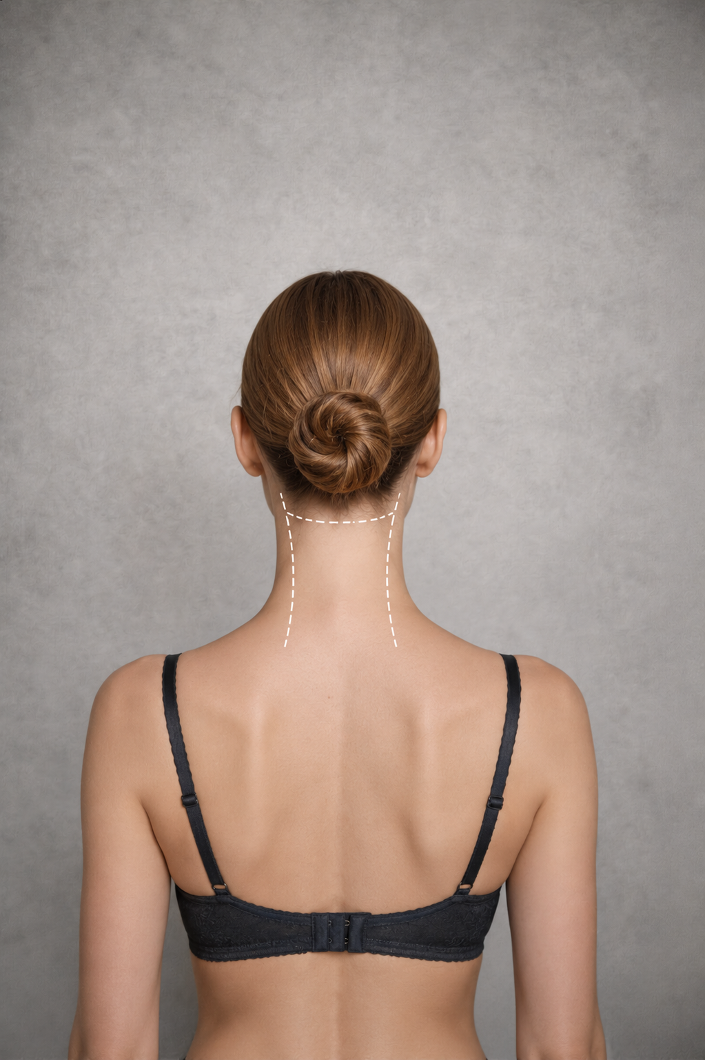 Back of Neck Laser Hair Removal Mildura