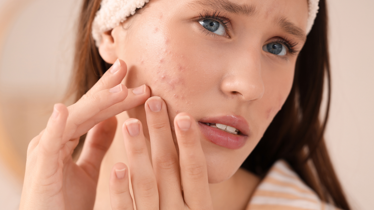 Skin Breakout & Congestion | Alpha-Beta Clear Peel
