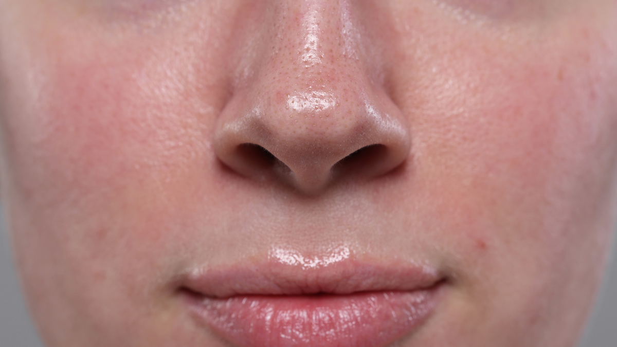 Anti-Aging & Sun Damage Program |  Catalyst Retinol Peel