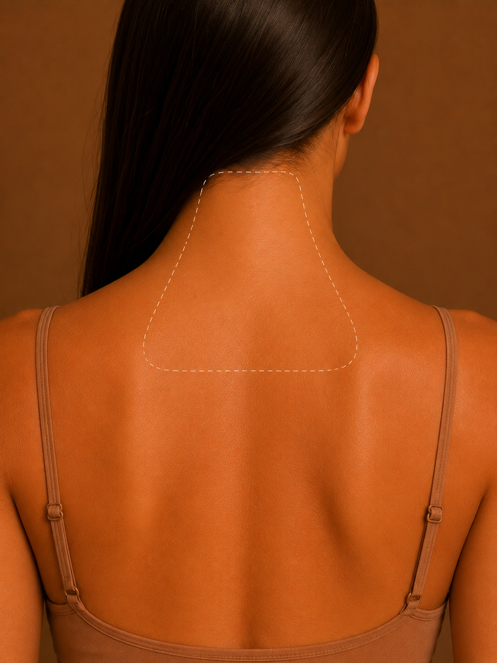 Back of Neck Laser Hair Removal Mildura