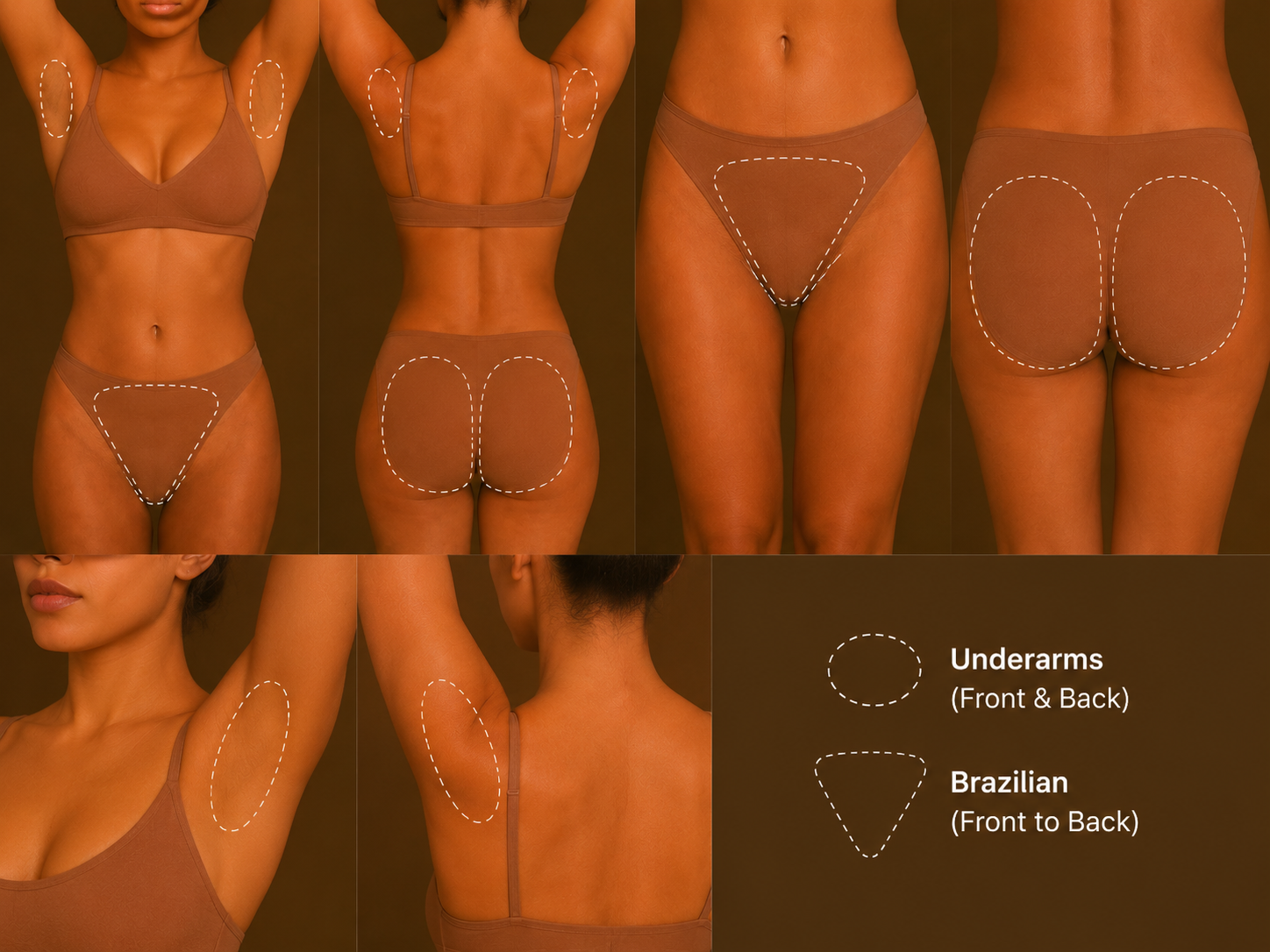 Brazilian and underarms laser hair removal treatment in Mildura