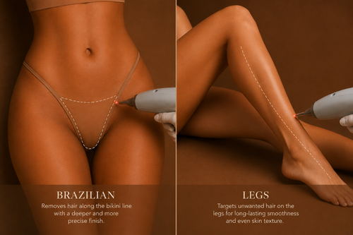 Brazilian and legs laser hair removal treatment in Mildura at Stellar Beauty