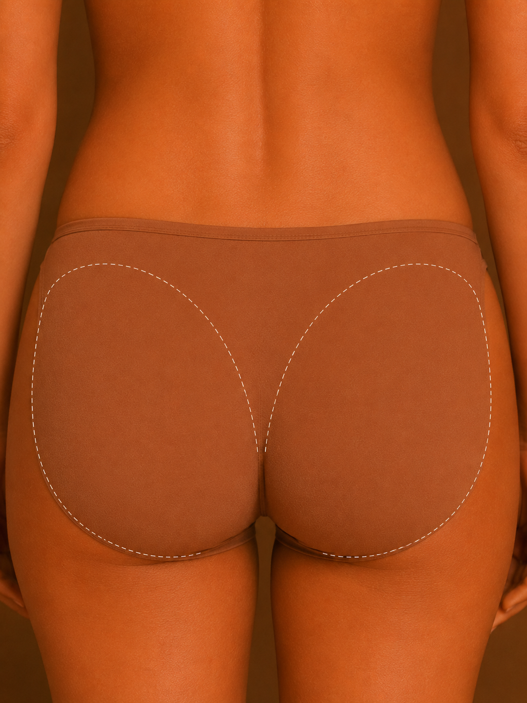 Buttocks laser hair removal treatment in Mildura