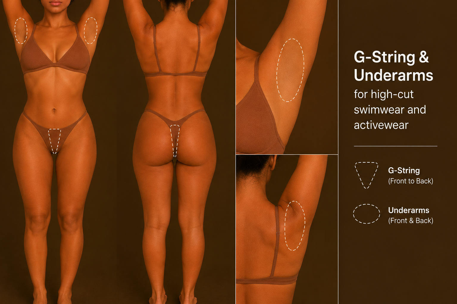 G-string and underarms laser hair removal treatment in Mildura