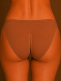 Gluteal line laser hair removal treatment in Mildura