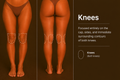 Knees laser hair removal treatment in Mildura