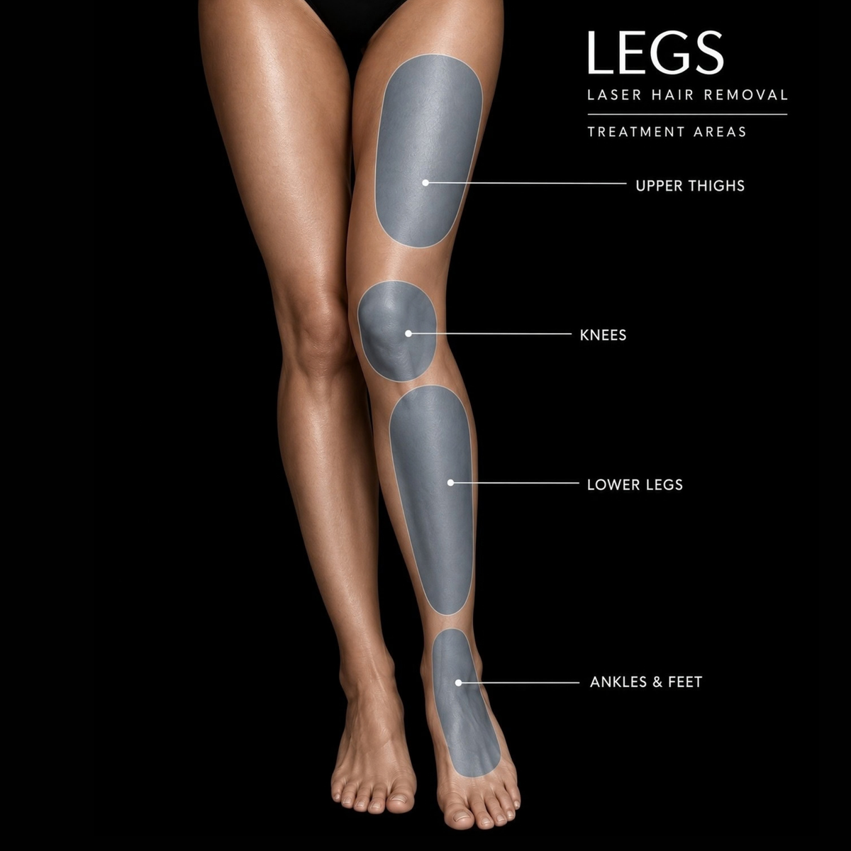 Full Legs