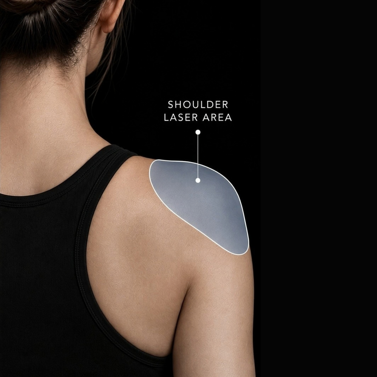 Shoulder Laser