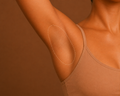 Underarm laser hair removal treatment in Mildura