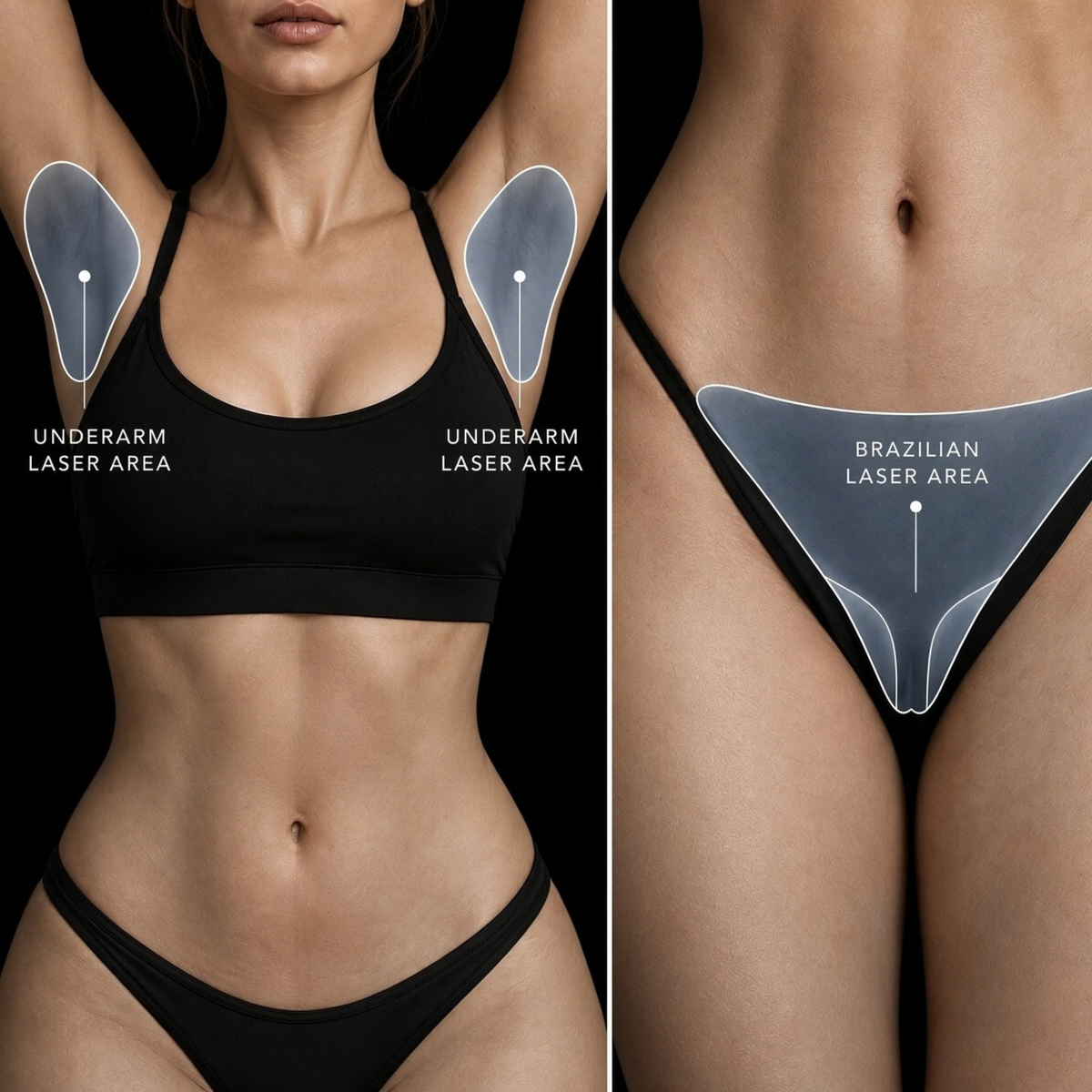 Bikini & Underarms Laser Hair Removal