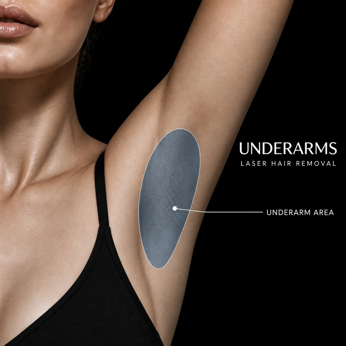 Underarm