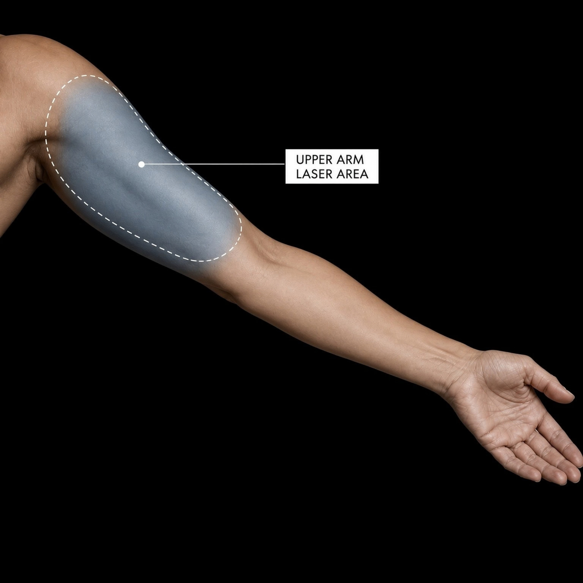 Half Arm